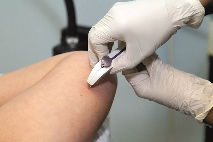 برداشتن ایمپلنت فقط چند دقیقه زمان میگیرد.